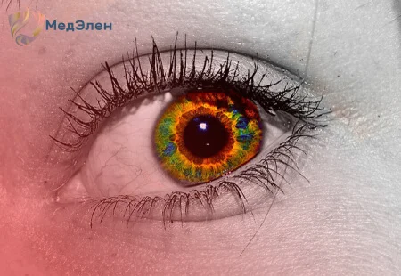 глаз